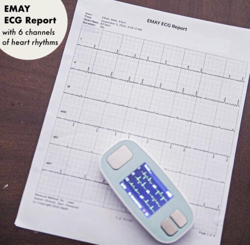 EMAY 6L Portable ECG Monitor | Record ECG and Heart Rate in 6 Channels | Compatible with Smartphone and PC | No Subscription Required - Image 4